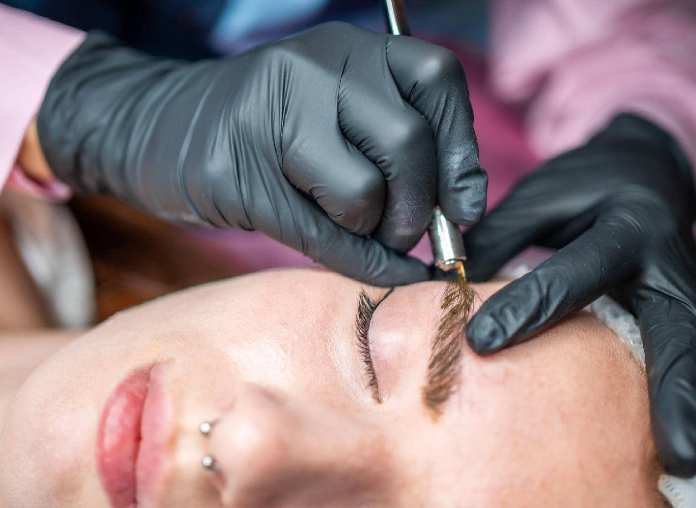 Eyebrow Transplant Procedure